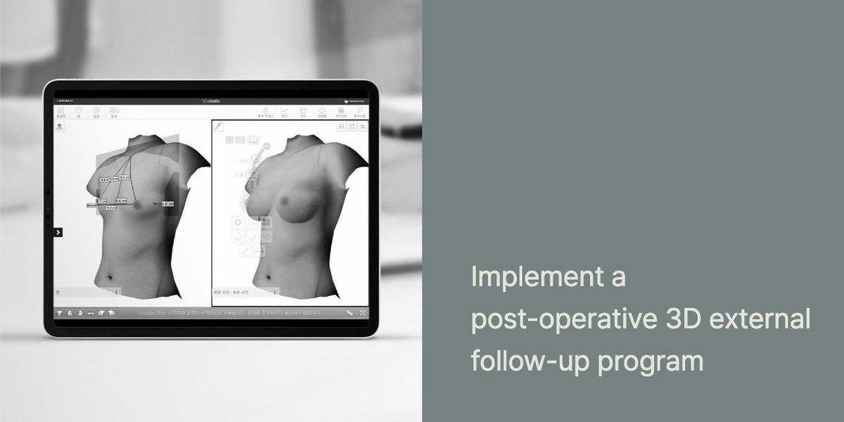 Aftercare scene 1: Implement a post-operative 3D external follow-up program