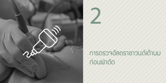 2. การตรวจอัลตราซาวนด์เต้านมก่อนผ่าตัด