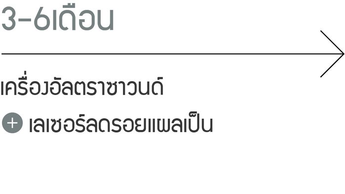 3-6 เดือน: เครื่องอัลตราซาวนด์, เลเซอร์ลดรอยแผลเป็น