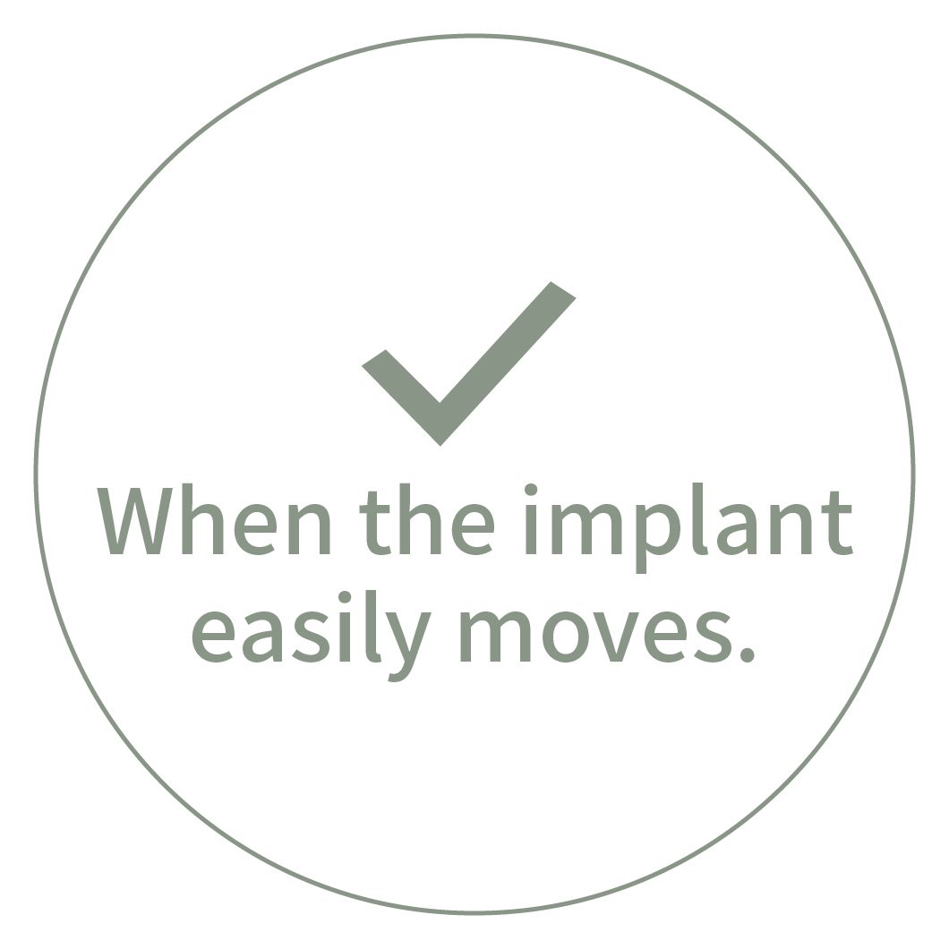 When the implant moves.
